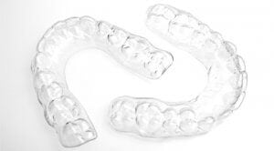 retenedor dental essix