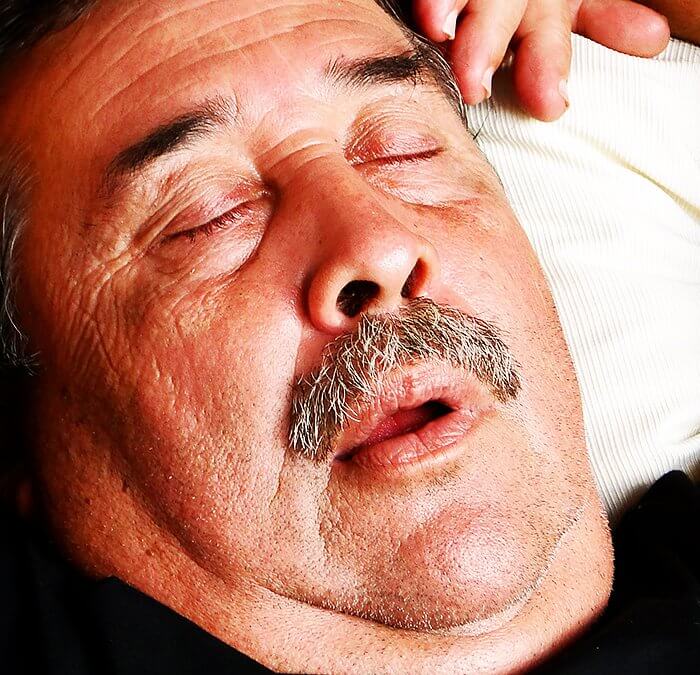 Apnea al dormir - Brackets y Ortodoncia en acapulco